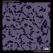 clostridium perfringens under microscope